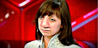 Яне Муратовой из передачи "Прямой эфир" сделали операцию на носу. Как девушка выглядит спустя 4 года